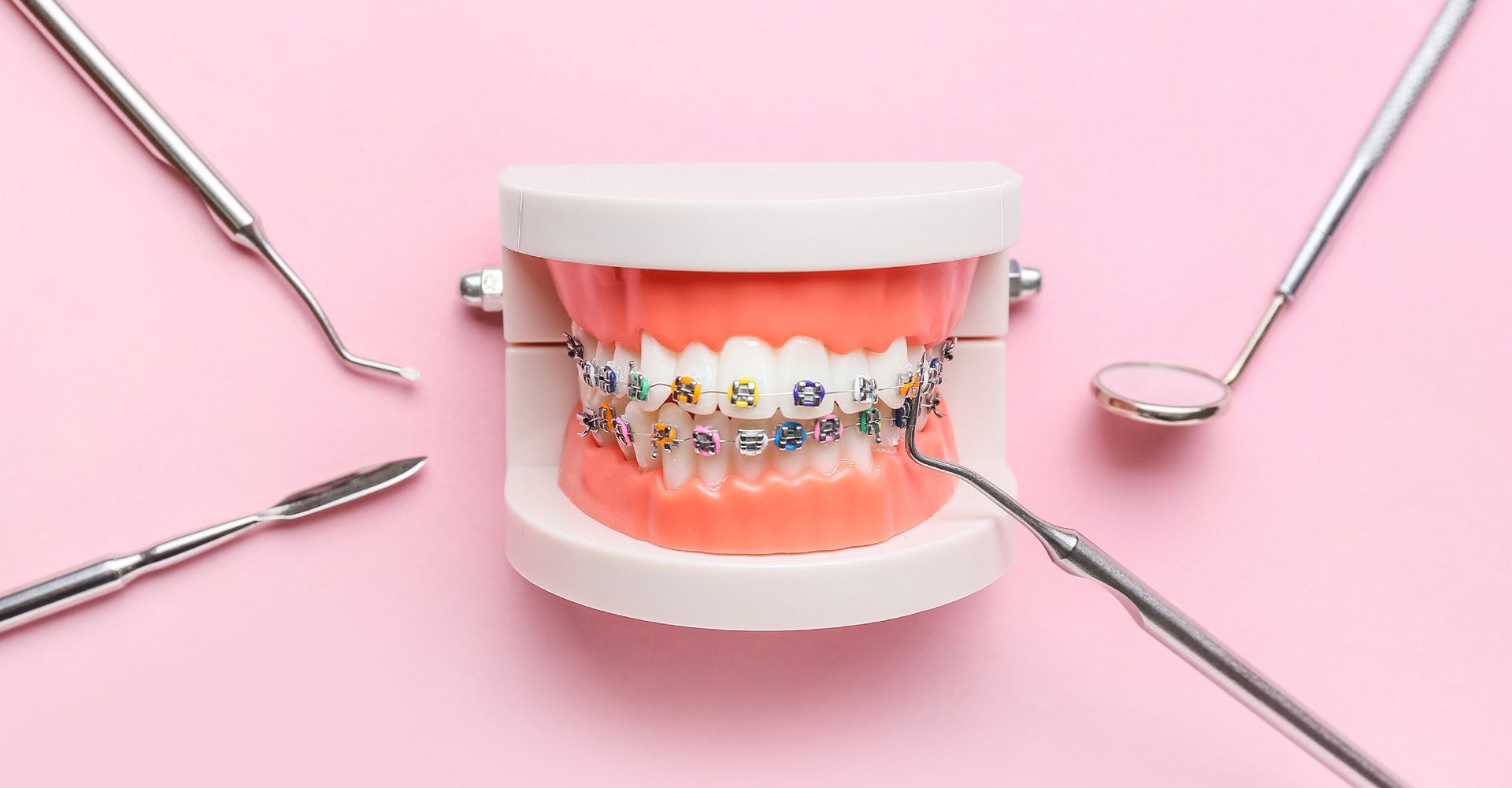 What Can You Expect During Your First Day of Having Braces?