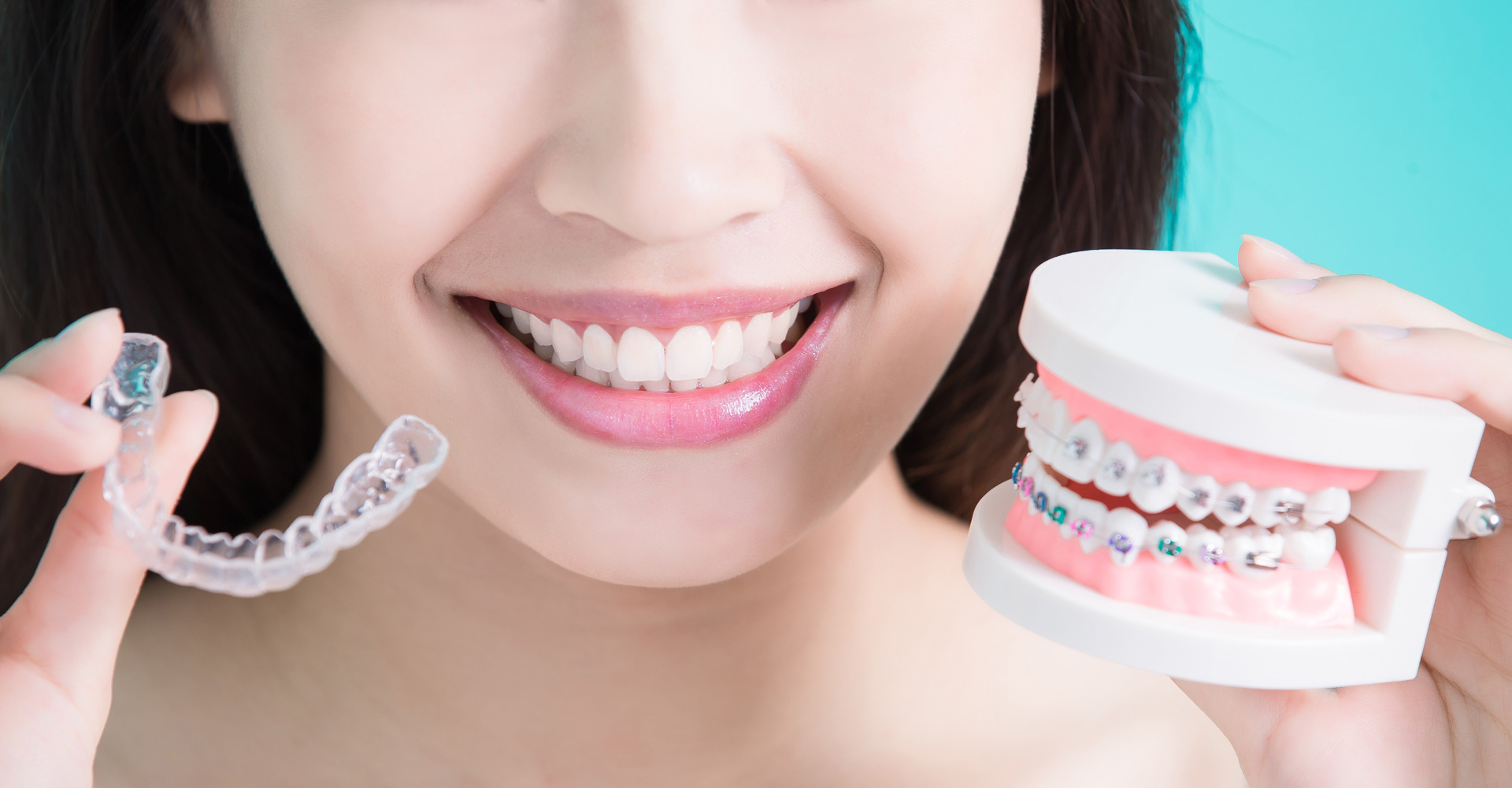 Invisalign vs. Braces: Which Is Right for You?