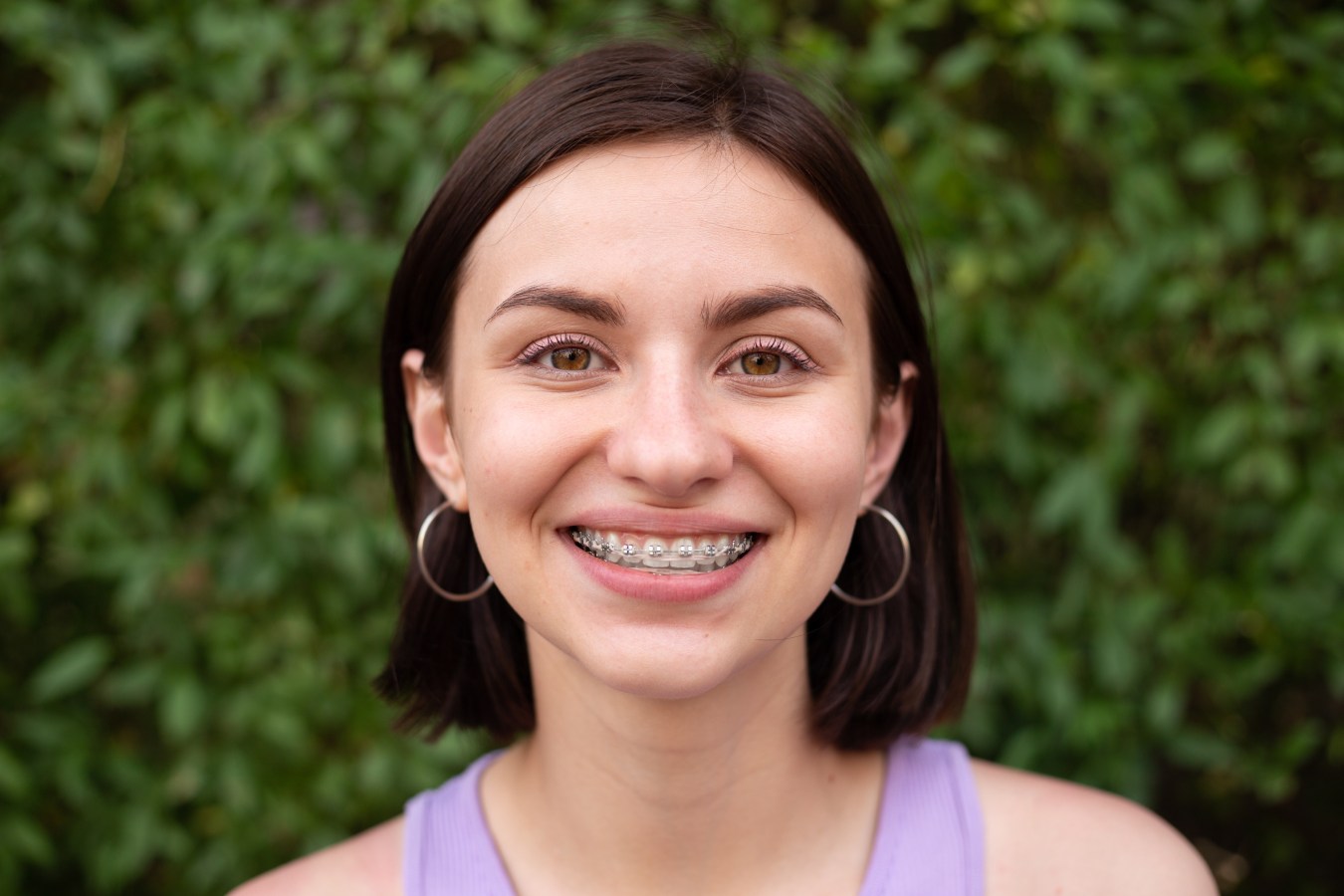 Types of Braces We Offer